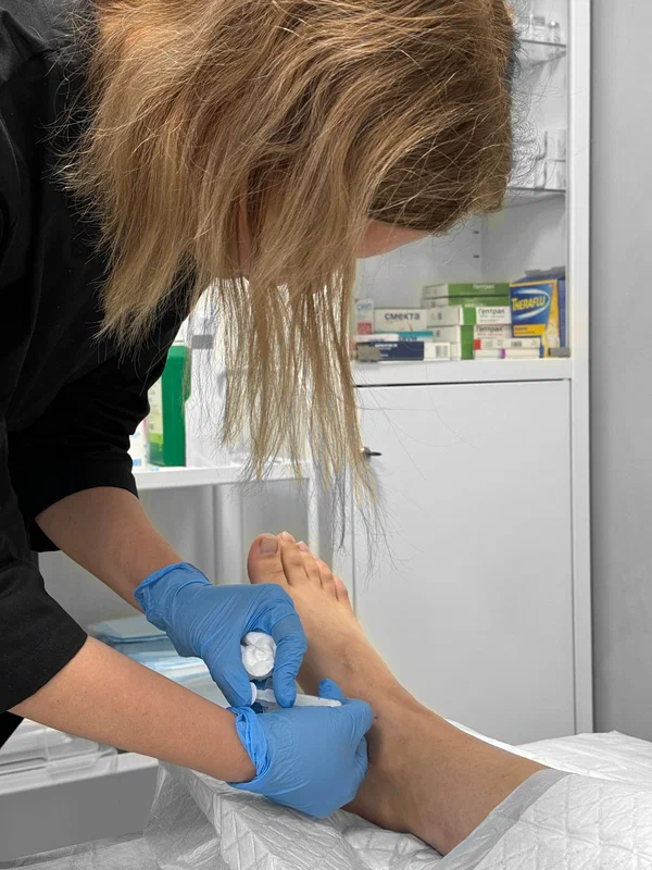 Фотогалерея: PRP-терапия - клиника SMART RECOVERY