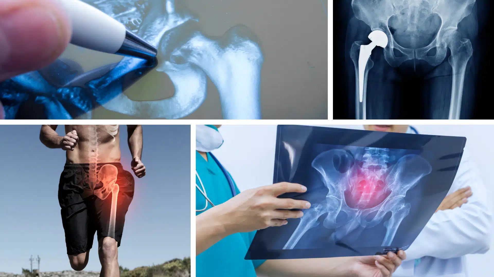 Боль в тазобедренном суставе - лечение и реабилитация